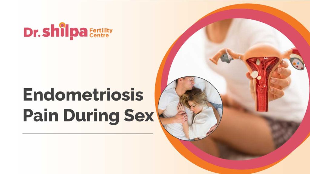 How to Prevent Endometriosis Pain During Sex Dr. Shilpa GB