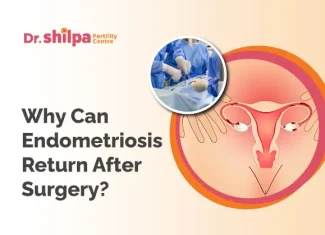 Can Endometriosis Come Back After Surgery?