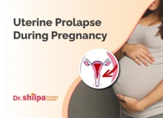 How to Manage Uterine Prolapse During Pregnancy?